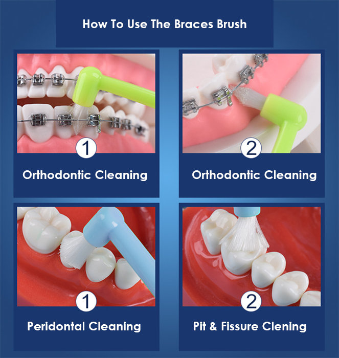 Braces Toothbrush The Healthy Smile Store